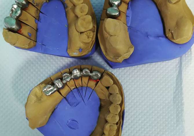 Klinika dentare ofron sherbime dentare Ortopedike , Kirurgjikale, Implante,dhe Terapi, 