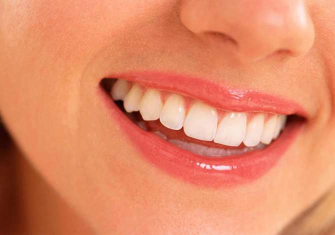 Health and Beauty Services in Tirana - 1,000 