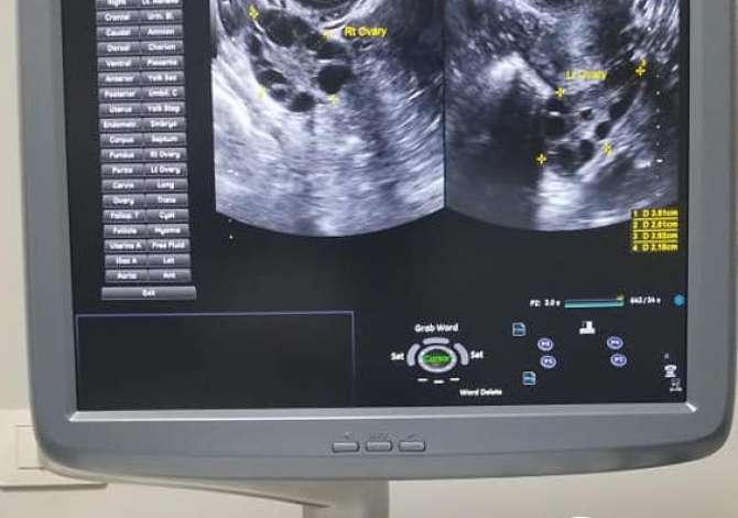 Klinika Gjinekologjike ofron sherbime per Ndjekje Shtatzanie, Eko, Pap test, Analiza Laboratorike, Nderprerje shtatzanie, Trajtim Infertiliteti