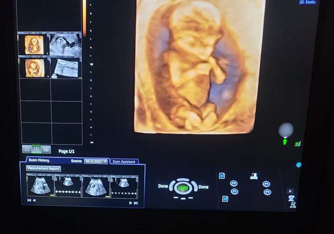 Klinika Gjinekologjike ofron sherbime per Ndjekje Shtatzanie, Eko, Pap test, Analiza Laboratorike, Nderprerje shtatzanie, Trajtim Infertiliteti