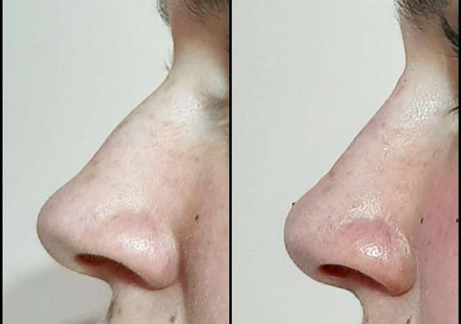 Health and Beauty Services  in Tirana - 1,000 Leke