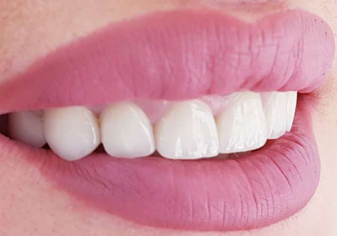 Health and Beauty Services  in Tirana - 1,000 