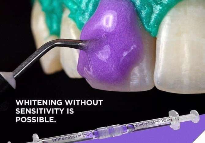 Materiale Dentare per ju dhe kliniken tuaj, Depo dentare per produkte me garanci 2 vjecare