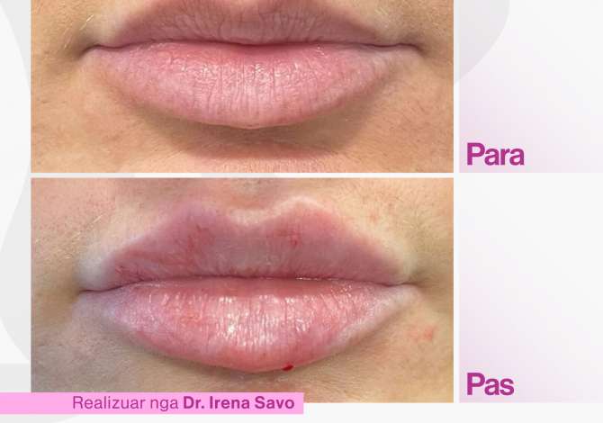 Klinike estetike  ofron trajtime per Rinimin dhe Rigjenerimin e  lekures, Tonifikimin, Celulitin, Eleminim i Tatuazheve etj.