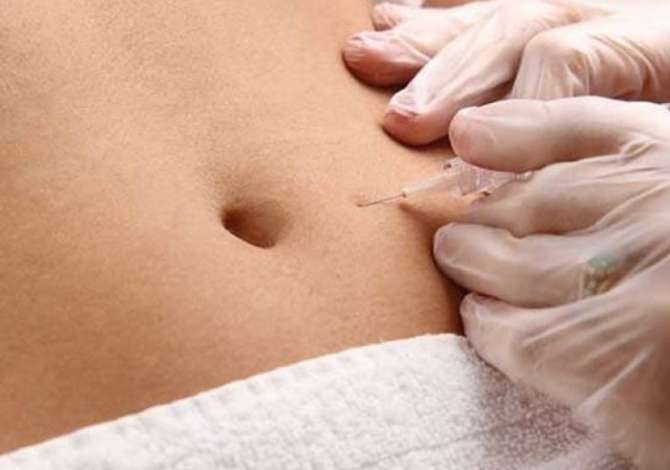 Health and Beauty Services  in Tirana - 10,000 
