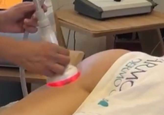 Klinika dermatologjike ofron trajtime  jo invazive, pa nevojen e nderhyrjeve kirurgjikale