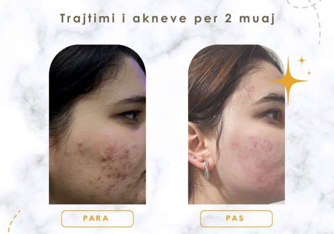 Sherbime Shendetesore dhe Estetike  ne Tirane - 1,000 