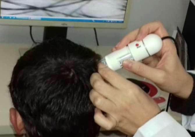 Klinika Dermatologjike-Estetike ofron Vizita Dermatologjike, Trikoskopi, Dermatoskopi, Trajtimin e akneve, Rrudhave, Renien e Flokeve etj.