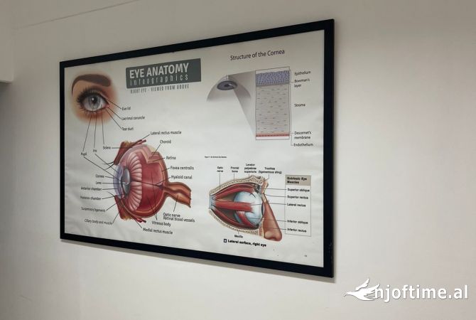 📢OKAZION!!! Shitet Biznesi OPTIKE te 21 Dhjetori🔑