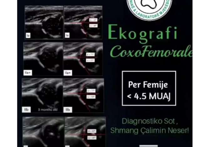 Klinike qe ofron sherbime per vizita mjeksore, Analiza Laboratorike, Ekografi, Skaner dhe Rezonance Magnetike