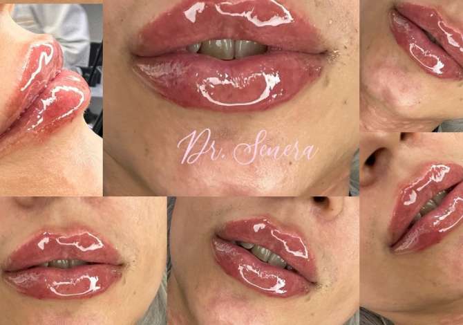 Kirurgji Plastike & Estetike kryesisht per fytyren