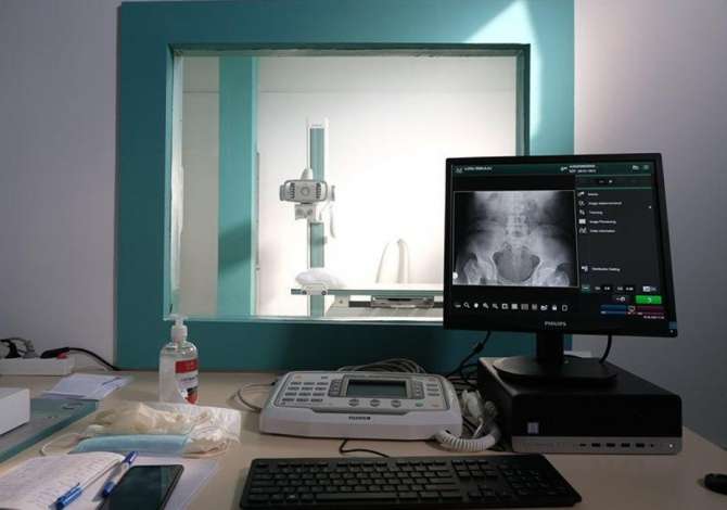 Qendra Diagnostike ofron sherbime si: Grafi konvencionale, Ekografi, konsulta Kardiologu, Gjinekologu, Pneumologu, Neurolog/EMG, Fizioterapi dhe Laborator analizash