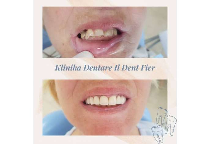 Health and Beauty Services  in Fier - 0 