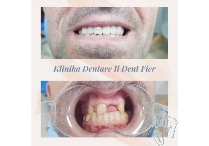 Health and Beauty Services in Fier - 0 