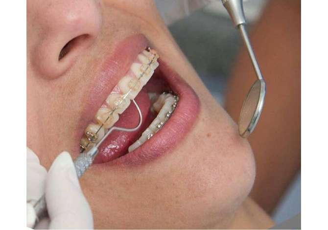 Health and Beauty Services in Fier - 0 