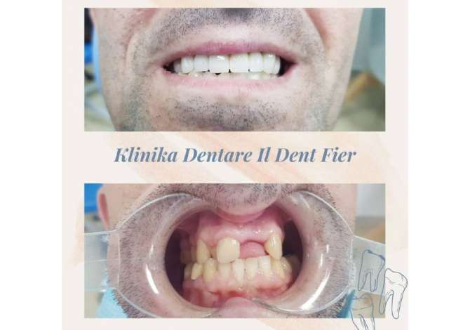 Health and Beauty Services  in Fier - 0 
