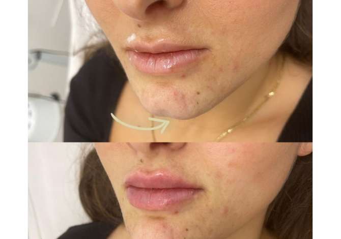 Health and Beauty Services  in Tirana - 0 