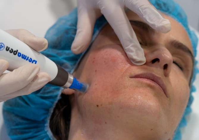 Health and Beauty Services in Tirana - 0 