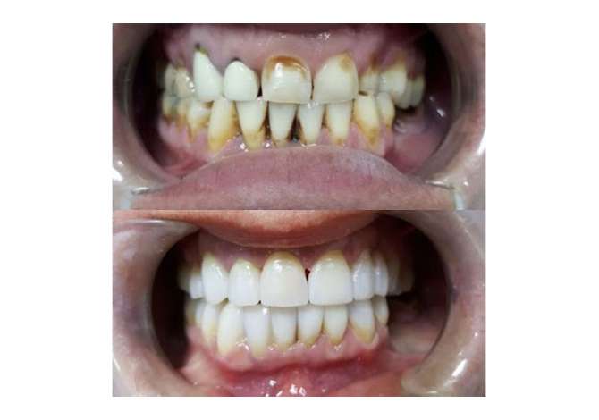 Klinike Dentare ofron game te gjere sherbimesh me cilesi dhe profesionalizem te larte