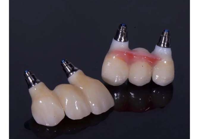 Klinike dentare ofron sherbime me profesionalitet te larte ne fushen e estetikes dentare,faciale,kirurgji orale-maksilo-faciale,implantologjise.