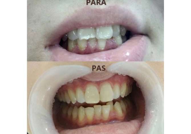 Health and Beauty Services  in Tirana - 0 