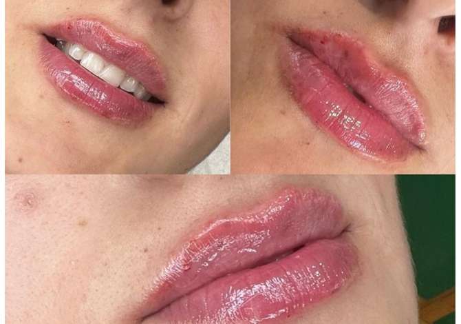 Sherbime Shendetesore dhe Estetike  ne Tirane - 30 Euro