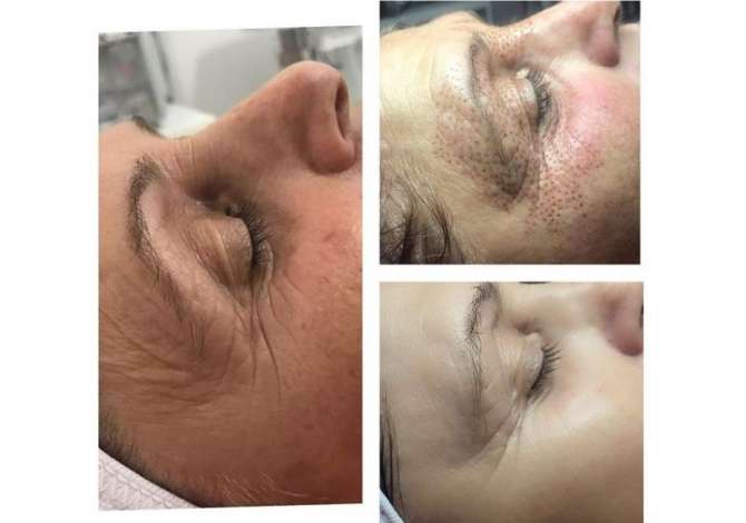 Health and Beauty Services  in Tirana - 0 