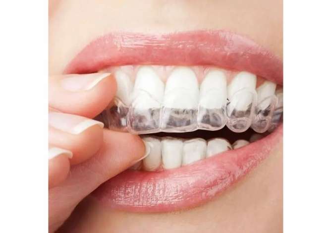 Klinika dentare Argjirodent ofron sherbime profesionale per implantologji, ortodonci fikse, drejtim dhembesh, zbardhim profesionale etj.