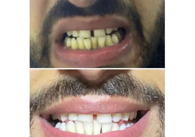 Health and Beauty Services  in Tirana - 0 