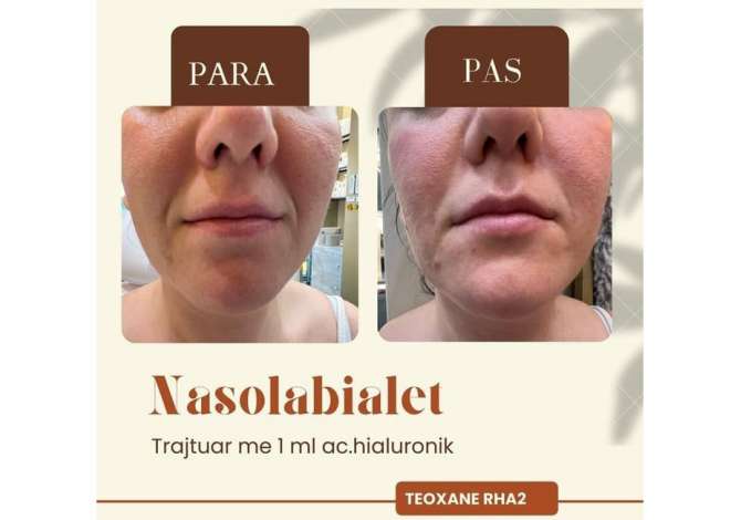 Health and Beauty Services  in Tirana - 0 