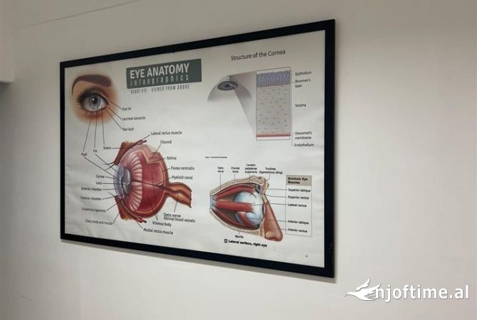 📢OKAZION!!! Shitet Biznesi OPTIKE te 21 Dhjetori🔑